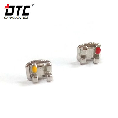 Les supports métalliques de la série DTC Bright sont la clé d'un traitement orthodontique de classe II réussi