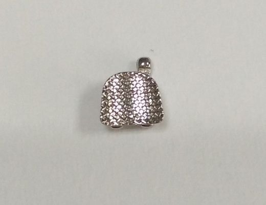 La durée de conservation des supports métalliques standard pour une correction orthodontique efficace est de 3 ans