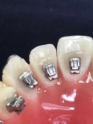 Clinique des tubes molaires des supports linguistiques dentaires pour les orthodonties DTC
