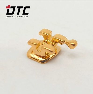 Découvrez le meilleur traitement orthodontique avec les supports en or certifiés CE de DTC Ortho