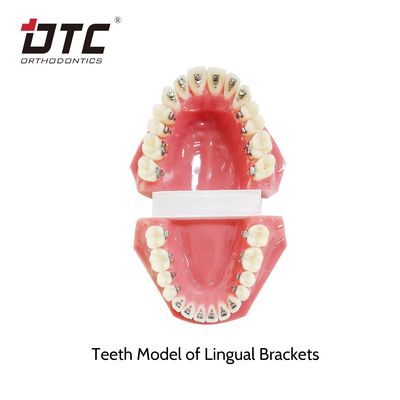 Des supports lingual ortodontiques DTC standard CE pour le traitement orthodontique mini