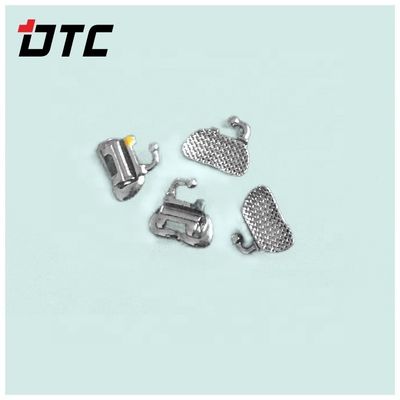 Tubes buccales convertibles en acier inoxydable La solution ultime pour l'orthodontie